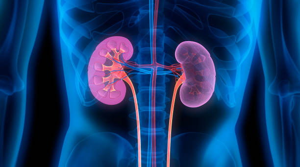 Understanding Chronic Kidney Disease